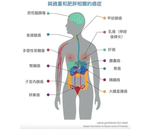 肥胖和癌症有關嗎？減重能降低罹癌風險嗎？